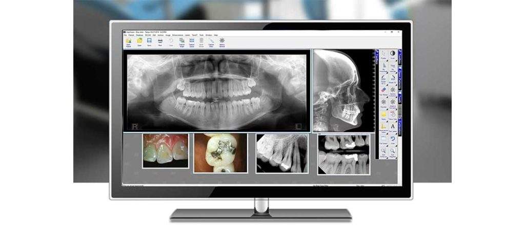 Xrayvision Patient Image Management Features: Apteryx XrayVision® - Planet DDS