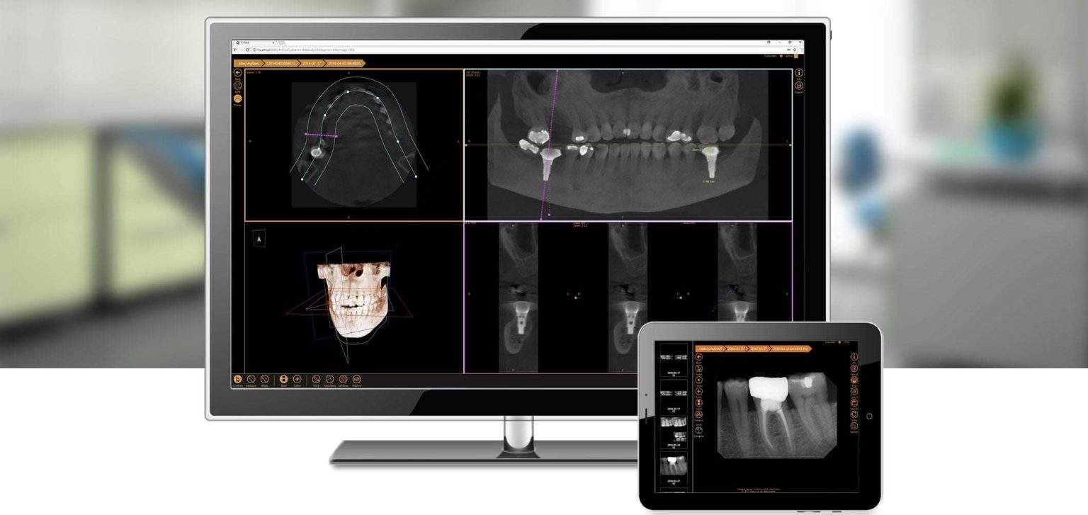 What is Open-Architecture Dental Imaging Software? - Planet DDS