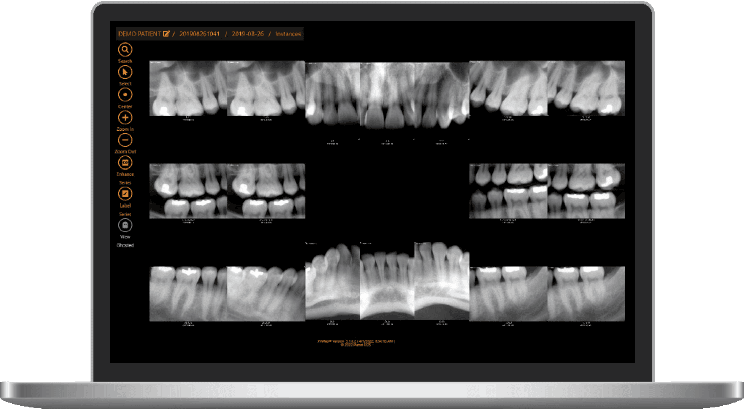 Apteryx XV Imaging Dental Imaging Software DDS