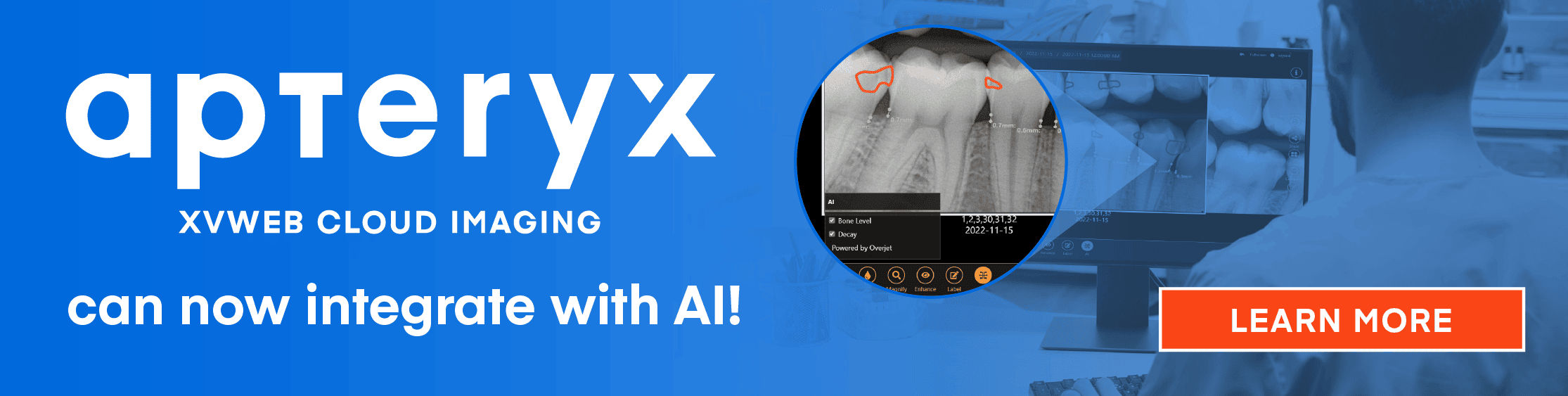 Apteryx XVWeb AI