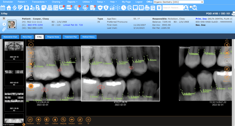 Denticon Dental Practice Management Software - Planet DDS