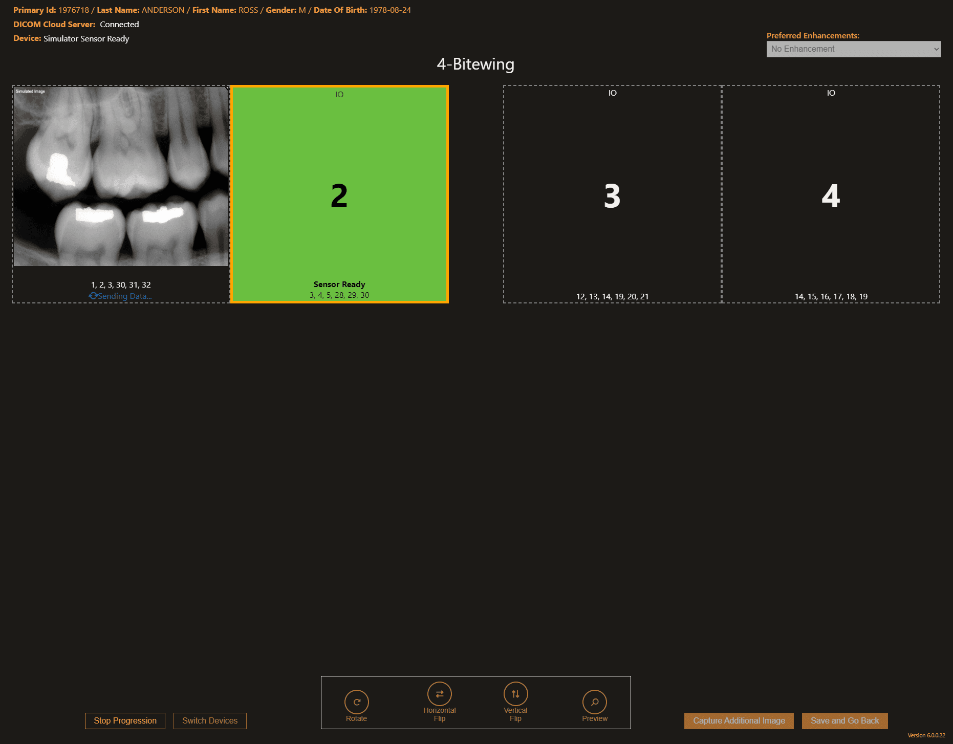 Apteryx simplified imaging workflow with fewer clicks.